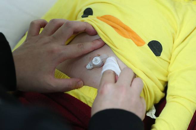 약물 투여를 마친 뒤 위루관 주변을 어머니가 닦아주고 있다. 강창광 선임기자 chang@hani.co.kr