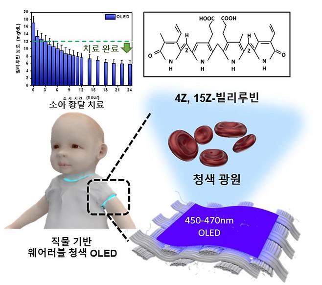 직물 기반 웨어러블 청색 OLED 신생아 황달 치료 개념도. /카이스트(KAIST) 제공
