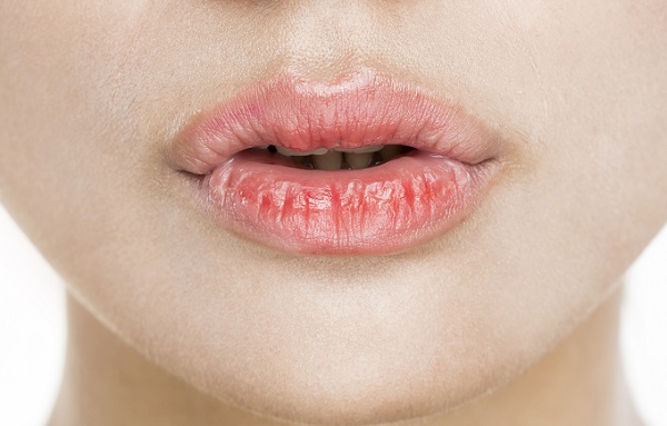 입술 각질을 함부로 뜯었다간, 세균 등에 의한 2차 감염이 발생할 수 있다./사진=클립아트코리아