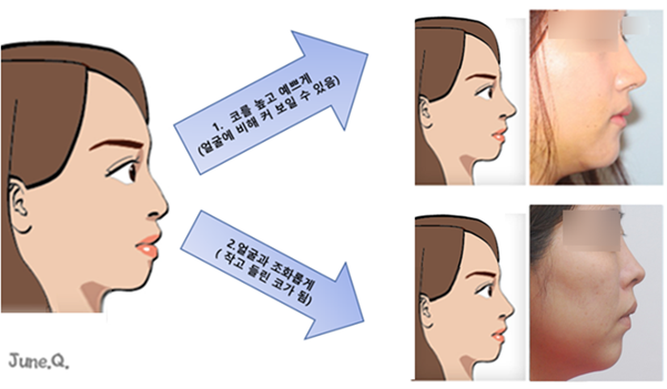 양쪽 다 아쉬운, 쉽지 않은 선택입니다.