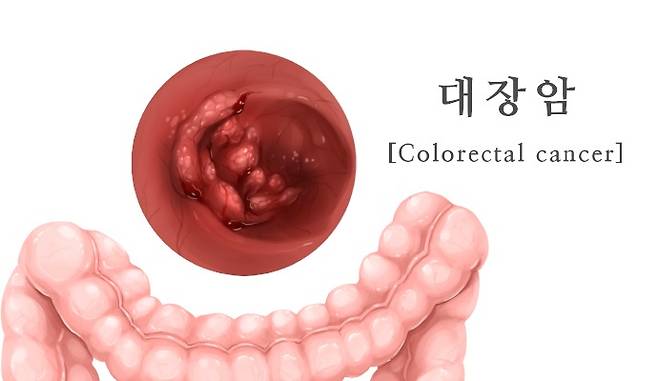 이미지투데이