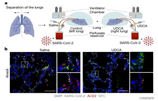 최근 UDCA가 코로나 감염 예방에 큰 효과가 있다는 연구 결과가 발표되었다ㅣ출처: Nature