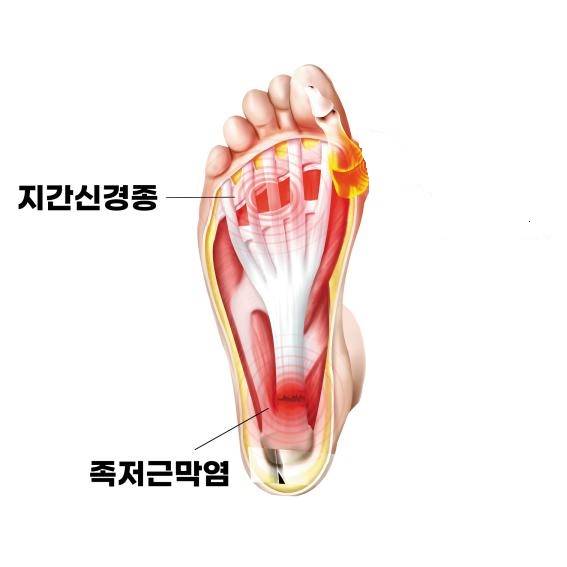 그래픽/ 헬스조선 DB