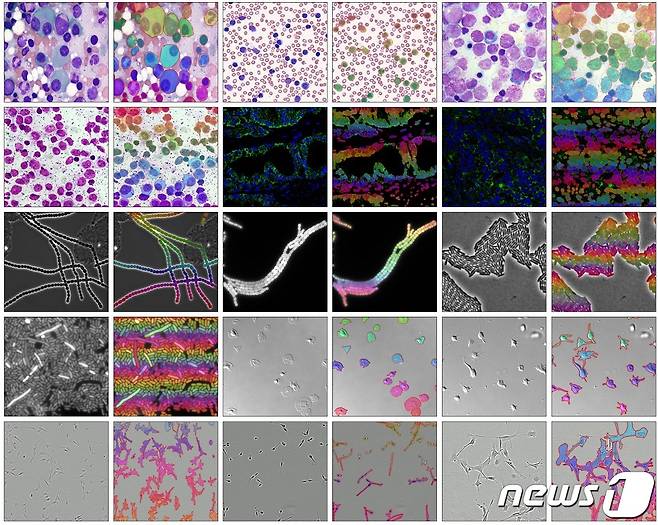 다양한 상황에서 관찰된 현미경 이미지에서 MEDIAR 인공지능이 세포를 인식한 결과. (KAIST 제공) /뉴스1