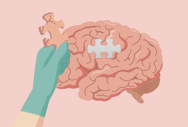 간병하는 사람의 고통이 큰 치매, 그 대표적인 원인은 '알츠하이머'다. [사진=solar22/게티이미지뱅크]