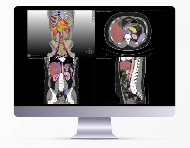 인체 장기를 실제와 동일한 3차원 디지털 트윈으로 구현해낸 '메딥프로' / 사진=메디컬아이피
