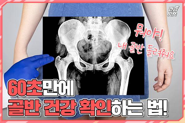 헬스조선 DB