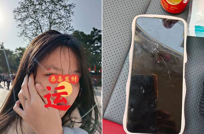 이 소녀는 침팬지가 갑자기 생수병을 던져 얼굴에서 피가 났고 휴대전화 액정이 박살났다며 관련 사진도 공개했다.