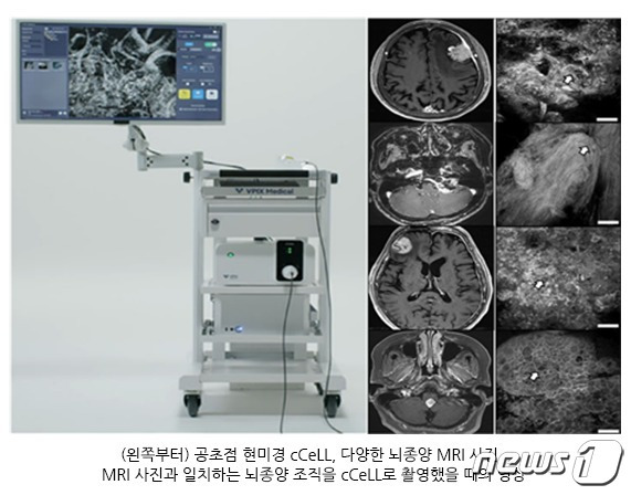 고려대학교안암병원 제공