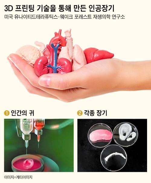 인간의 장기를 대체할 수 있는 유기체 기반의 인공장기 시장이 평균수명 연장과 장기 부족 심화로 최근 급성장하고 있다. /미국 유나이티드테라퓨틱스, 웨이크 포레스트 재생의학연구소, 게티이미지
