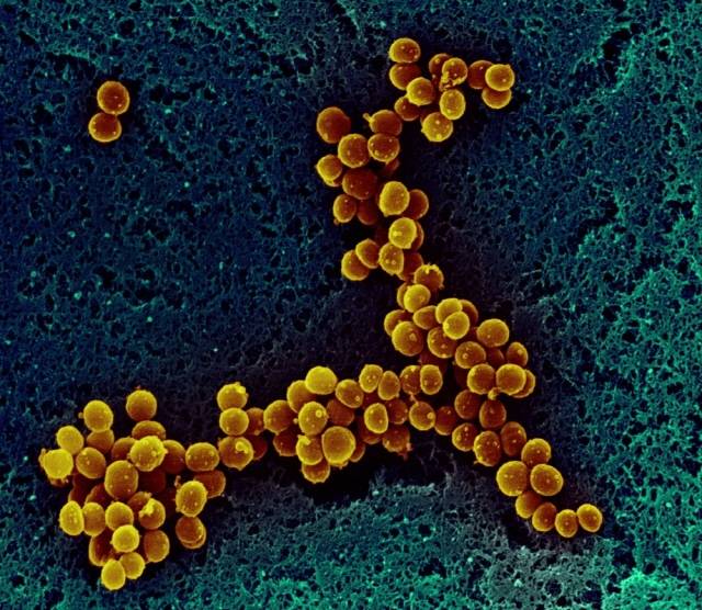 여러 질환을 일으킬 수 있는 황색포도상구균을 건강한 사람 중 30%가 이미 보유하고 있으므로 평소 손을 깨끗이 씻는 게 매우 중요하다./사진=클립아트코리아