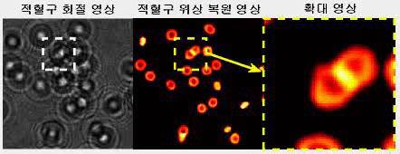 3차원 공간에서 매우 빠르게 움직이는 적혈구 회절 영상을 AI 영상 복원 기술을 통해 선명하게 복원한 모습



KAIST 제공