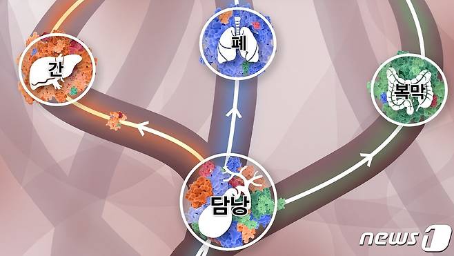 담낭에 다양한 클론들이 섞여 있다가, 주황색 클론이 이긴 암세포는 간으로, 파란색 클론이 이긴 암세포는 폐로, 초록색 클론이 이긴 암세포는 복막으로 간다.(분당서울대 병원 제공)