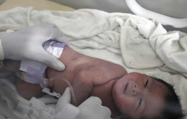 시리아 지진 피해 현장에서 구조된 신생아. AP연합뉴스
