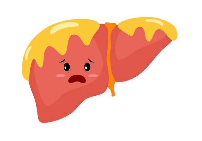 술을 안 마시거나 적게 마시는 사람의 간에 지방이 많이 쌓인 것을 '비알코올성 지방간'이라고 한다. [사진=Blueastro/게티이미지뱅크]