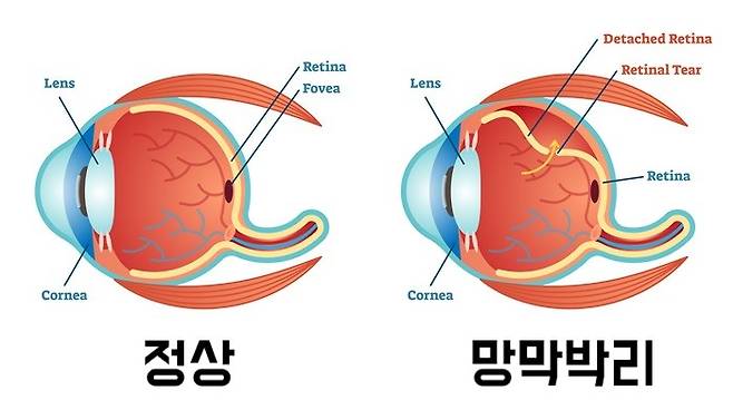 출처: 게티이미지뱅크