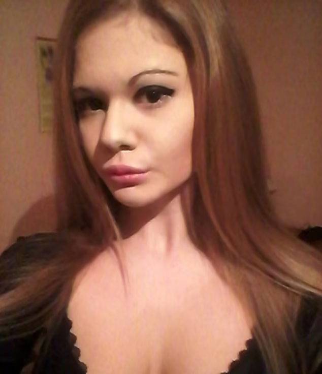 안드레아 이바노바가 필러 시술을 받기 전의 모습. / 사진-안드레아 이바노바 인스타그램