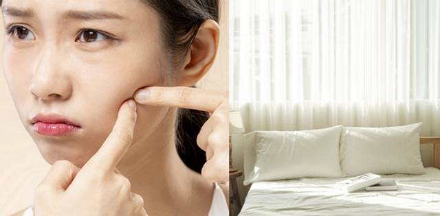 침구류를 자주 세탁, 교체해주지 않으면 여드름이 생길 수 있다. 이미지투데이