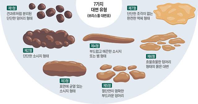 브리스톨 대변표(Bristol Stool Chart)./사진=게티이미지뱅크