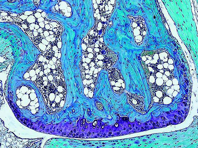 뼈의 길이와 모양을 결정하는 유전자를 확인하는 연구에서 활용한 쥐의 연골 조직. 사진 출처 위키미디어