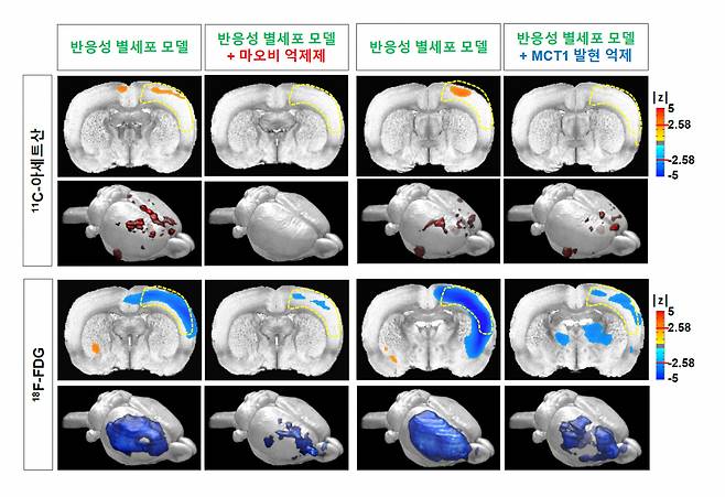 반응성 별세포 동물 모델에서 PET 영상 촬영을 통해 관찰되는 11C-아세트산 흡수 증가와 18F-FDG 흡수 감소.[IBS 제공]