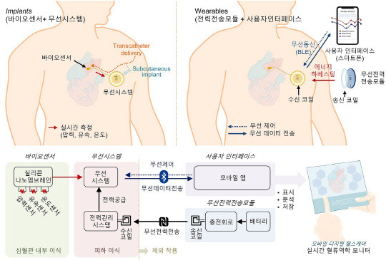 무선 심혈관 임플란트 시스템의 구성도