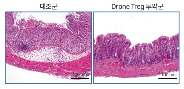 염증 유도에 의해 망가진 대장 조직(왼쪽)과 Drone Treg 세포치료제에 의해 복구된 대장 조직 조직병리 사진(지아이셀 제공)