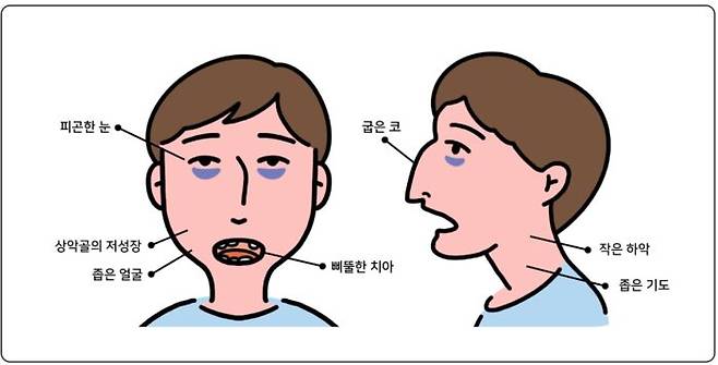 [그래픽=부산 예스치과의원]