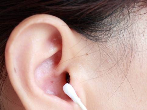 적당량의 귀지는 오히려 귀 건강에 도움이 되므로 억지로 제거하지 않아도 된다./사진=게티이미지뱅크