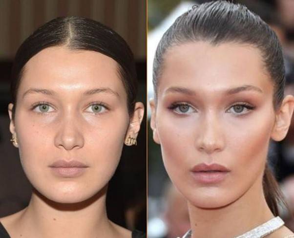 벨라 하디드. [사진= 닥터 패트릭 브릭스(Dr Patrick Briggs) 페이스북]