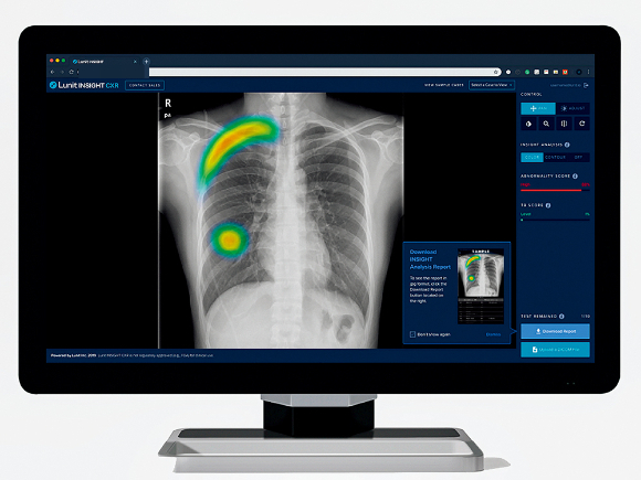 국내 인공지능(AI)영상진단 기업 중 루닛은 항암 분야에 강점을 보이며 외국인투자자의 주목을 받고 있다. 사진은 루닛의 흉부 엑스레이 AI 영상분석 설루션 루닛인사이트 CXR 운영화면. /사진=루닛