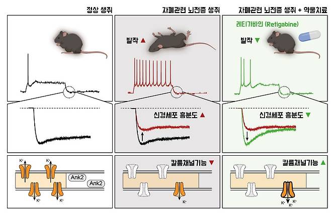 약물치료를 통한 자폐 관련 뇌전증 증상 완화를 보여주는 그림./IBS