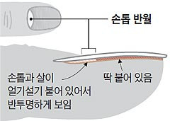 헬스조선DB