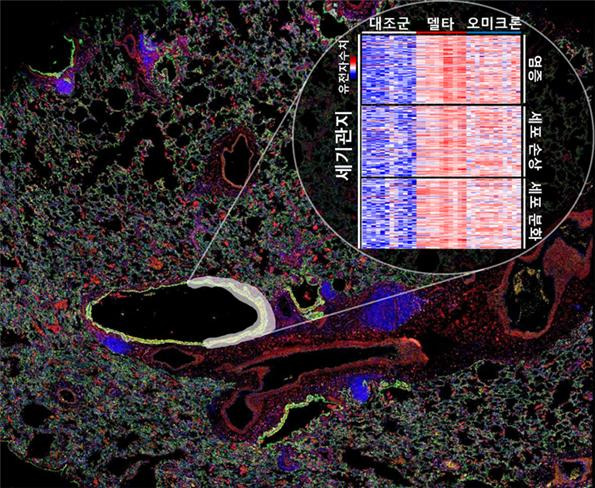 델타 및 오미크론에 감염된 폐 미세구조에 대한 공간전사체 분석. 한국생명공학연구원 제공.