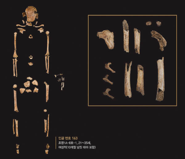 출산 중 사망의 극적인 예(임당 유적 조영동 고분군)가 있다. 무덤 안에는 21~35세 여성으로 추정되는 인골이 놓여 있었는데, 그 옆에 열 달 남짓 성장한 태아의 뼈가 있었다. 출산 과정에서 혹은 출산을 전후한 시점에서 산모가 태아와 함께 사망한 것으로 추정된다. / 영남대박물관 제공