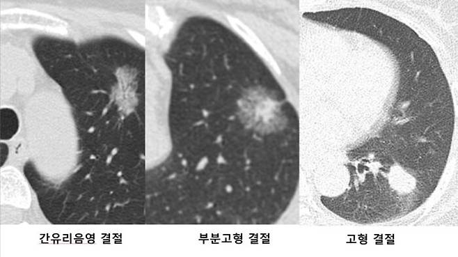 [사진=손춘희 광혜병원 호흡기내과 과장 제공]