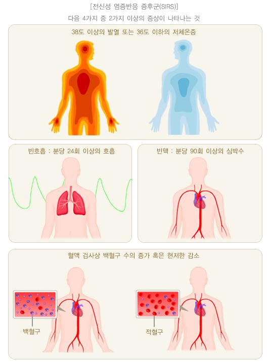 미생물 감염으로 패혈증이 발병하면 전신성 염증반응 증후군이 나타난다. 보건복지부 제공