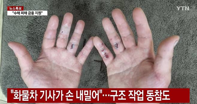 충북 청주시 오송 지하차도에서 차량 17대가 물에 잠기는 참사가 발생한 가운데 침수 당시 시민들을 구조한 '남색 셔츠 의인'이 증평군청 공무원 정영석씨인 것으로 확인됐다. 사진은 정씨의 손. /사진=YTN 보도화면 캡처