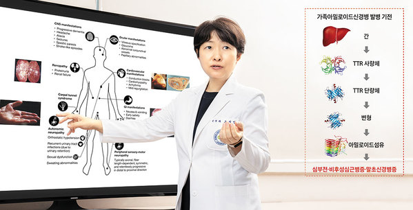 건국대병원 신경과 오지영 교수가 아밀로이드라는 단백질 찌꺼기가 체내 쌓이며 생길 수 있는 다양한 증상을 설명하고 있다. / 김지아 헬스조선 객원기자