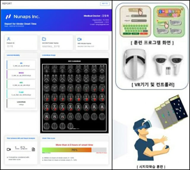 (왼쪽부터) Stroke Onset Time AI, Nu.T (사진=식품의약품안전처)