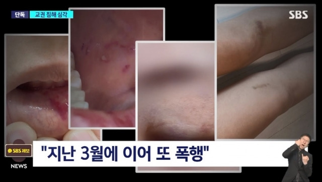 서울 한 초등학교에서 여교사가 다른 학생들이 보는 앞에서 6학년 남학생에게 무차별 폭행을 당한 사건이 벌어졌다. SBS 보도화면 캡처