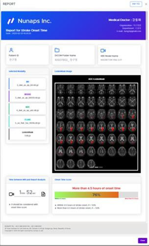 뉴냅스의 스트로크 온셋 타임 AI [식약처 제공. 재판매 및 DB 금지]