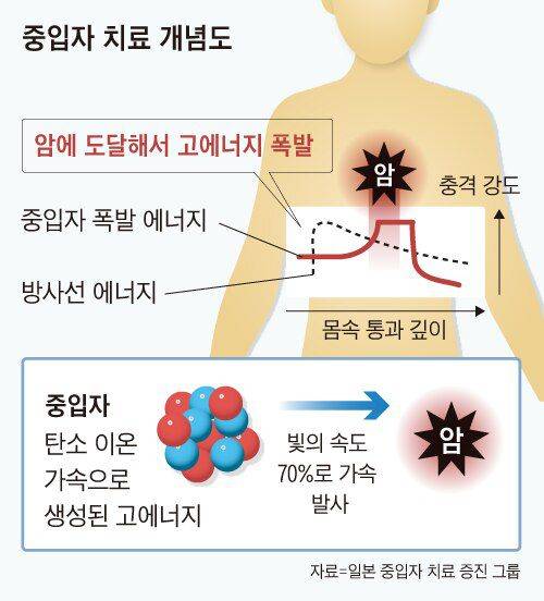 중입자 치료 개념도/조선DB