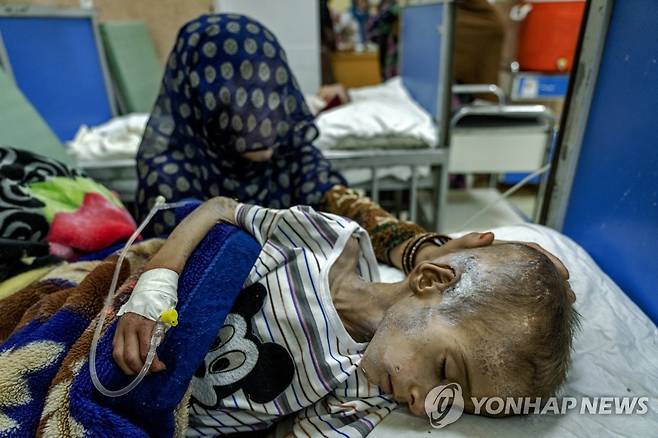 2022년 5월 카불 병원에 입원해 있는, 영양실조에 걸린 소년 [AP 연합뉴스 자료사진. 재판매 및 DB 금지]