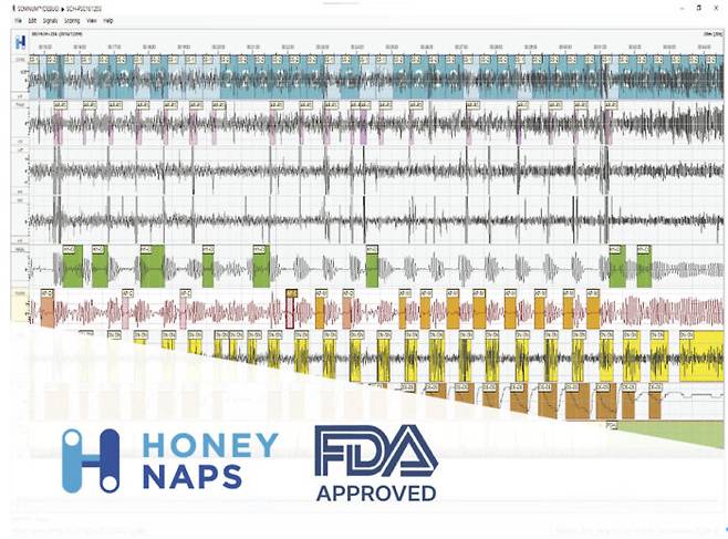 AI 수면 분석 솔루션 '솜눔'의 구동 예시 화면 [사진=허니냅스]