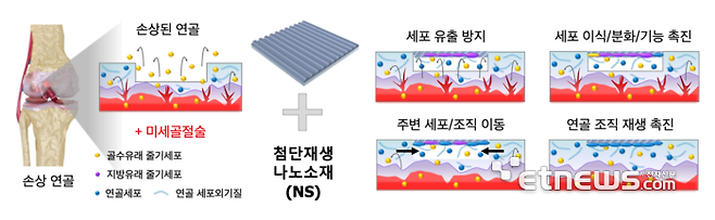 첨단재생소재를 활용한 무릎연골재생 촉진 기술및 메커니즘.