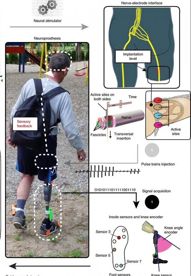 잃어버린 다리를 대신하는 의족은 어느 정도 기능을 수행하지만 환지통, 넘어질 위험성, 무게감 등 여러 문제가 있다. 의족이 땅에 닿을 때 정보를 신경에 전달하는 감각 피드백 장치로 체화 정도를 높인 의족을 쓰면 이런 문제들을 상당 부분 해결할 수 있다. 네이처 의학 제공