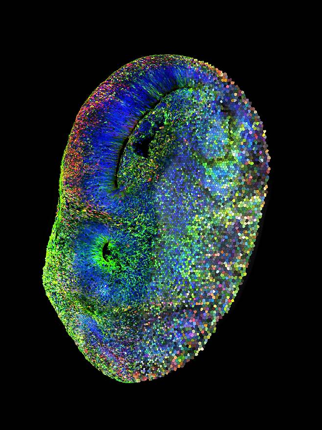 유전자 돌연변이를 가진 세포는 붉은색으로 표시한 인간 뇌 오가노이드의 현미경 사진. 여러 세포에서 동시에 각각 다른 돌연변이를 유발해 자폐에 관여하는 유전자들을 한 번에 확인할 수 있다./오스트리아 과학원 분자생명공학연구원(IMBA)