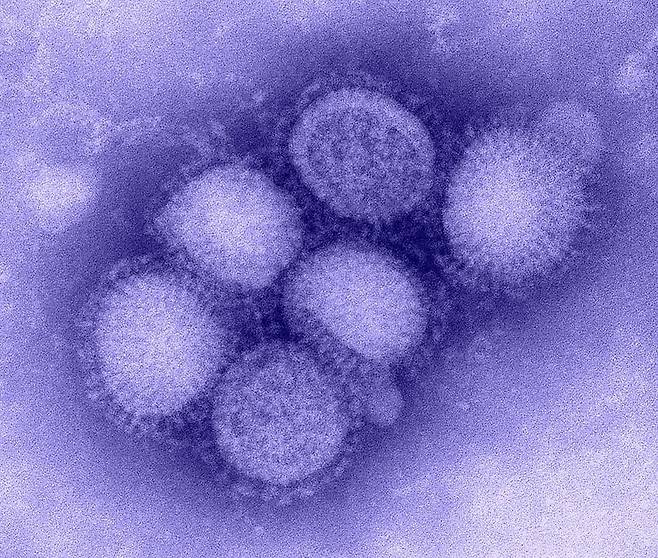 인플루엔자 바이러스의 전자현미경 사진. 국내 연구진이 인플루엔자 바이러스 감염 진단 시간을 대폭 줄였다./미 질병통제예방센터