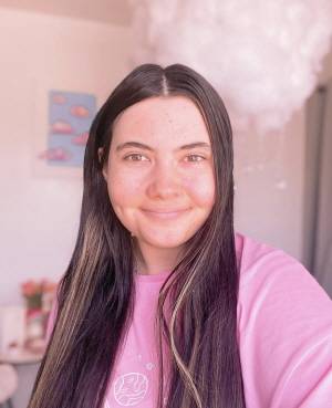 테사 한센-스미스는 수성 알레르기를 앓아 수분에 닿기만 하면 피부에 두드러기가 생긴다./사진=테사 한센-스미스 SNS 캡처